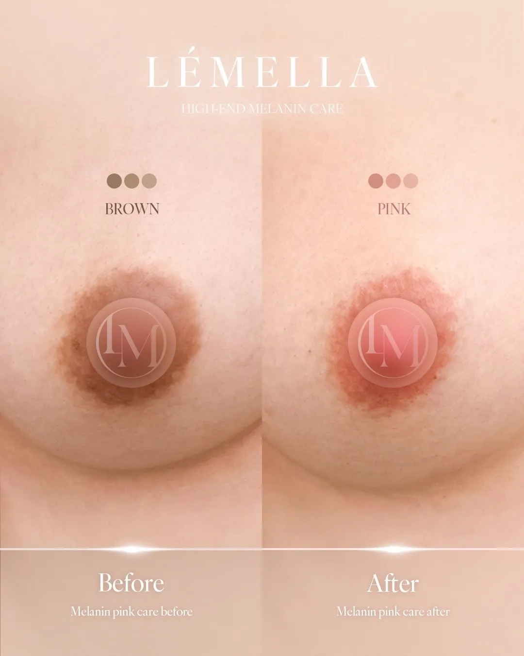 バストトップ(乳輪)