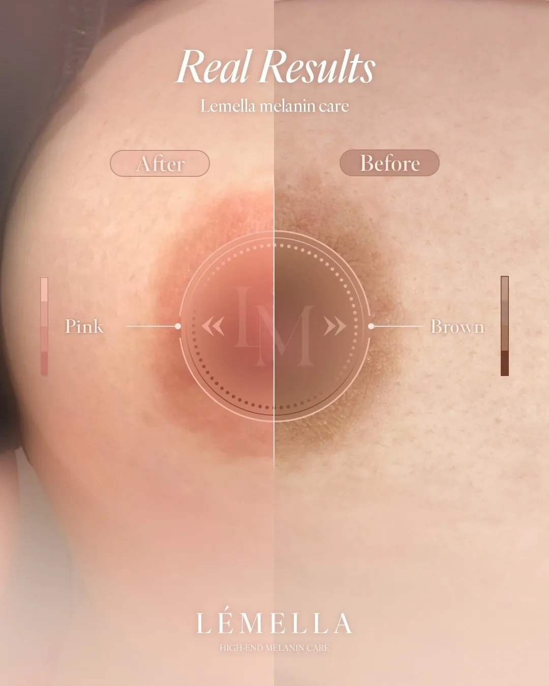 バストトップ(乳輪)